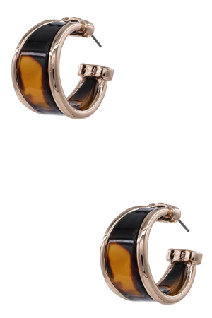 Tortoise Acetate Statement Hoop Earrings